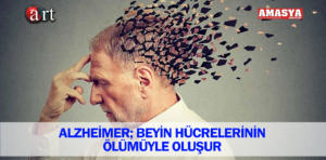 alzheimer hastalığı 1